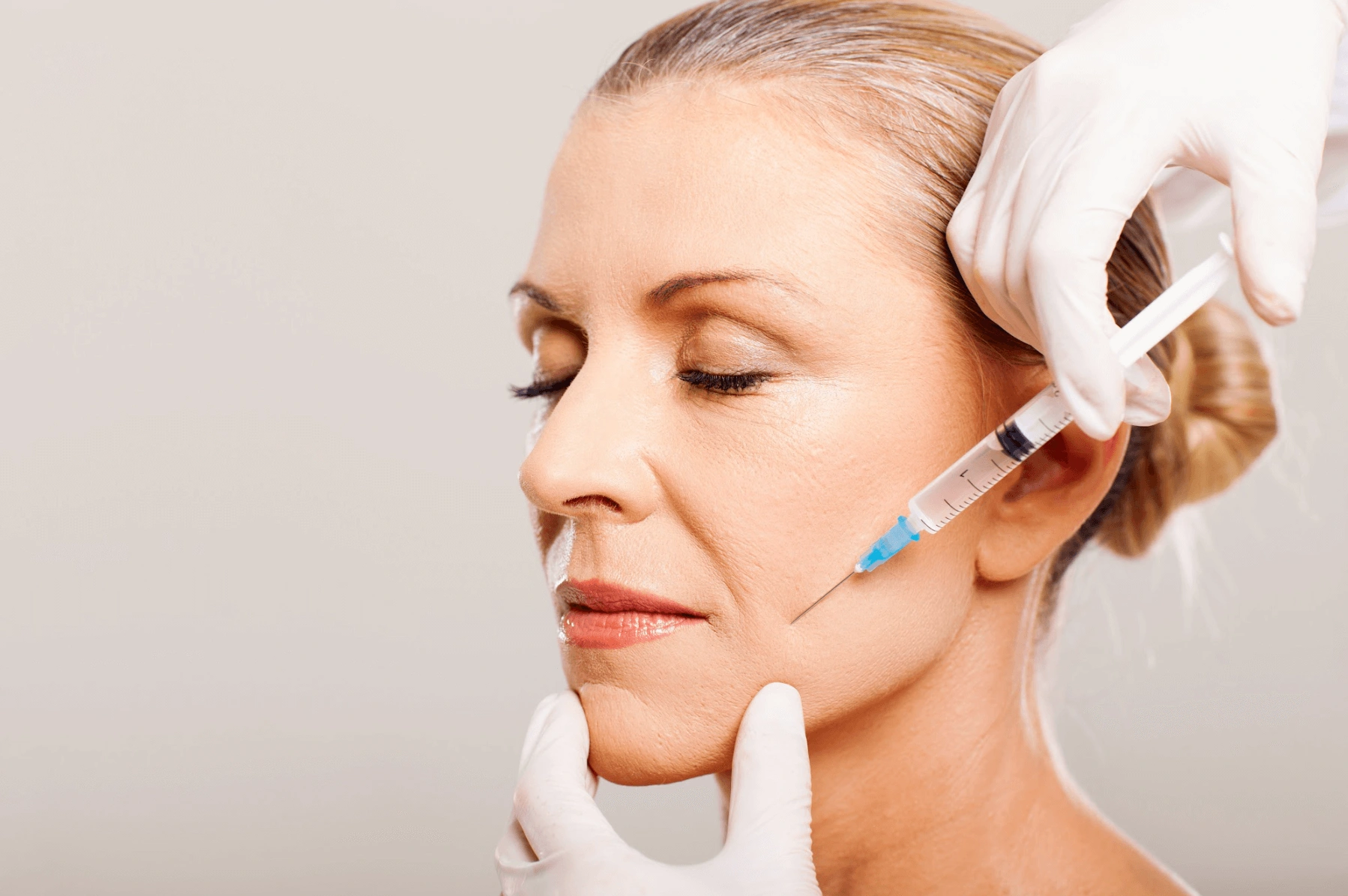 How Long Can Cheeks Stay Plump after JUVÉDERM® Treatment?